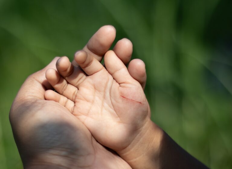 יד עם סריטה של ילד קטן אחוזה ביד של מבוגר ברקע של צמחיה